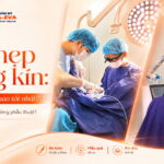 tham-my-thu-hep-vung-kin-phuong-phap-nao-tot-nhat-nen-phau-thuat-hay-khong-phau-thuat