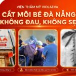 vien-tham-my-violaeva-cat-moi-be-da-nang-khong-dau-khong-seo