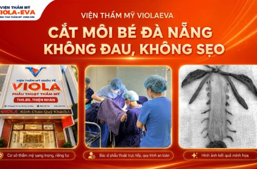 vien-tham-my-violaeva-cat-moi-be-da-nang-khong-dau-khong-seo