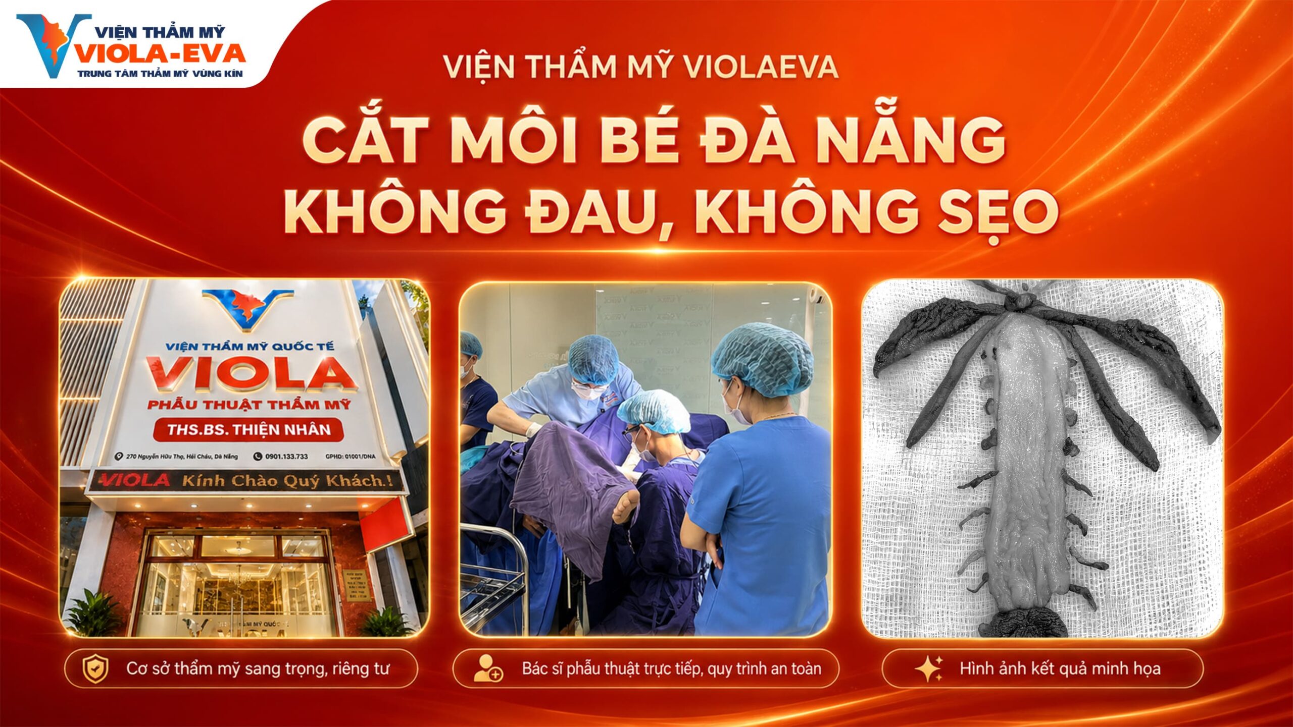 vien-tham-my-violaeva-cat-moi-be-da-nang-khong-dau-khong-seo