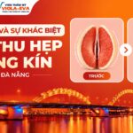 dac-diem-va-su-khac-biet-khi-thu-hep-vung-kin-tai-da-nang