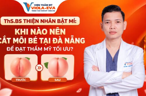ths.bs-thien-nhan-bat-mi-khi-nao-nen-cat-moi-be-tai-da-nang-de-dat-tham-my-toi-uu