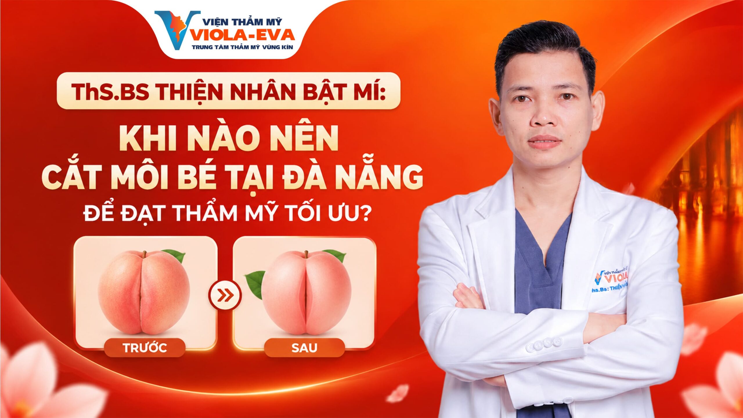 ths.bs-thien-nhan-bat-mi-khi-nao-nen-cat-moi-be-tai-da-nang-de-dat-tham-my-toi-uu