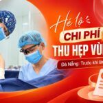 he-lo-chi-phi-thu-hep-vung-kin-da-nang-truoc-khi-lam-nen-biet-gi