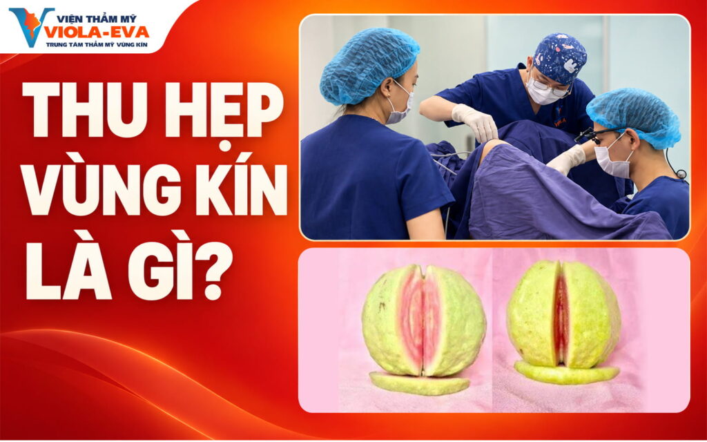 thu-hep-vung-kin-la-gi