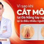vi-sao-cat-moi-be-tai-da-nang-tay-nghe-bac-si-lai-la-dieu-nhieu-nguoi-quan-tam